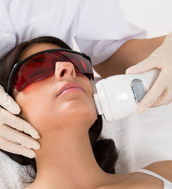 smartxide face laser treatment
