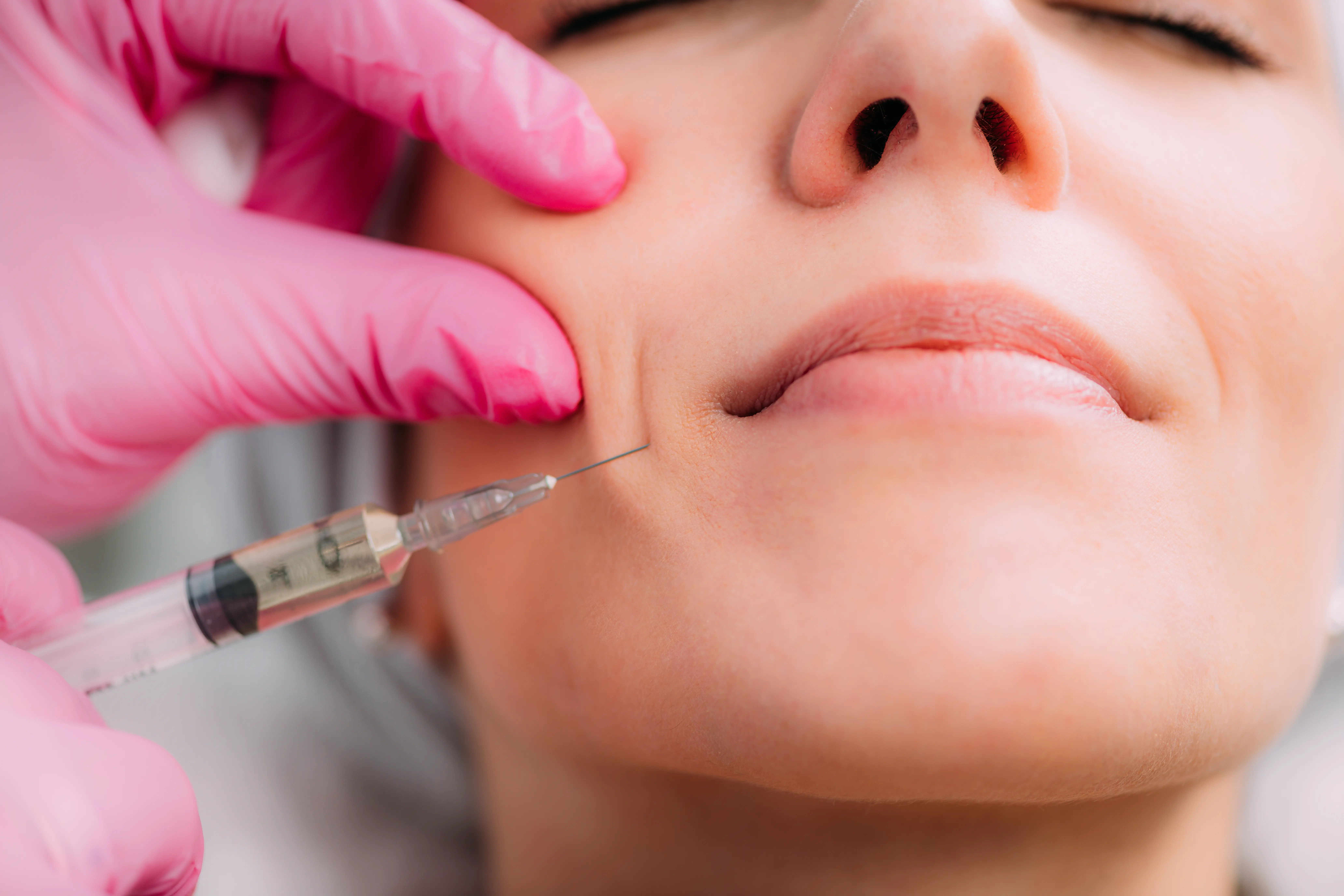 youthful-facial-volume-natural-contours
