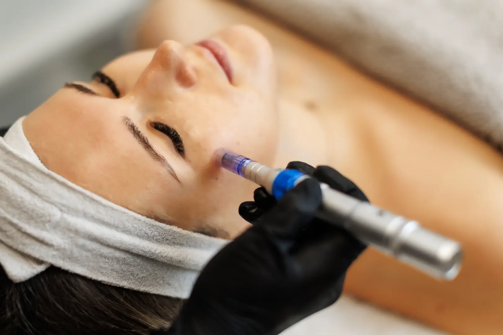 Practitioner performs SkinPen microneedling on a person's cheek while they lie on a treatment bed.