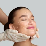 Read more about the article Lines vs. Lost Volume: Choosing the Right Filler for Your Face