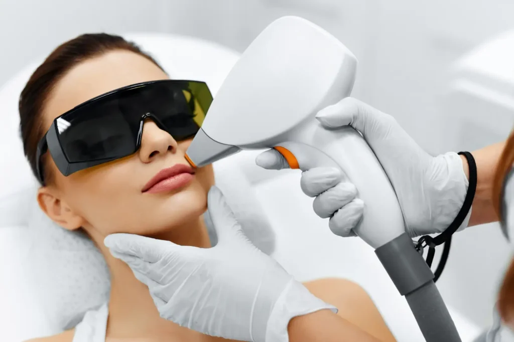 Woman wearing protective eyewear while a practitioner holds a laser device near her upper lip.